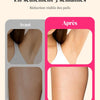 Epilateur Lumière Pulsée Laser 999,900 Flashes IPL Epilation Definitive Indolore corps entier