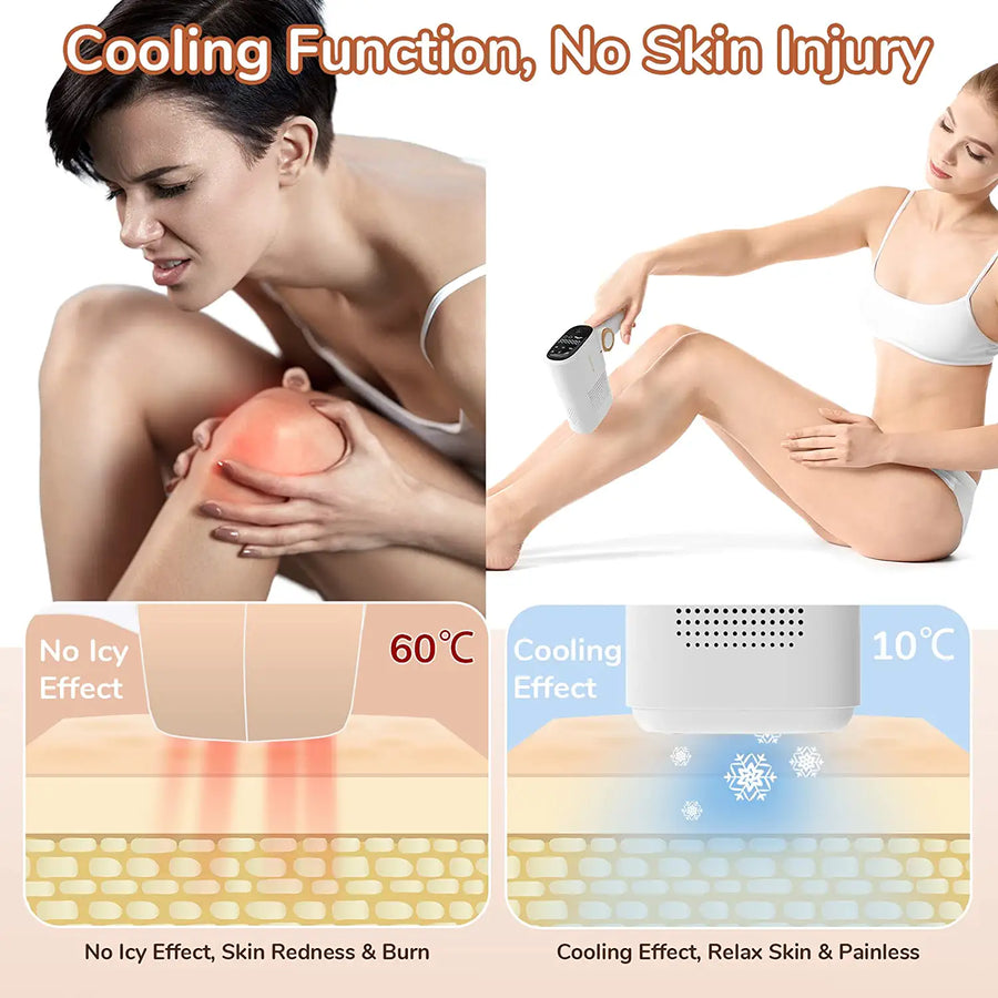 Epilateur Lumière Pulsée Laser 999,999 Flashes IPL Epilation Definitive Indolore corps entier