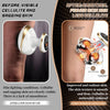 Masseur de cellulite 4 en 1, appareil de massage sous vide avec 9 niveaux de thérapie thermique et LED rouge-bleu, pour raffermissement du corps à la maison Sculpture anti-cellulite