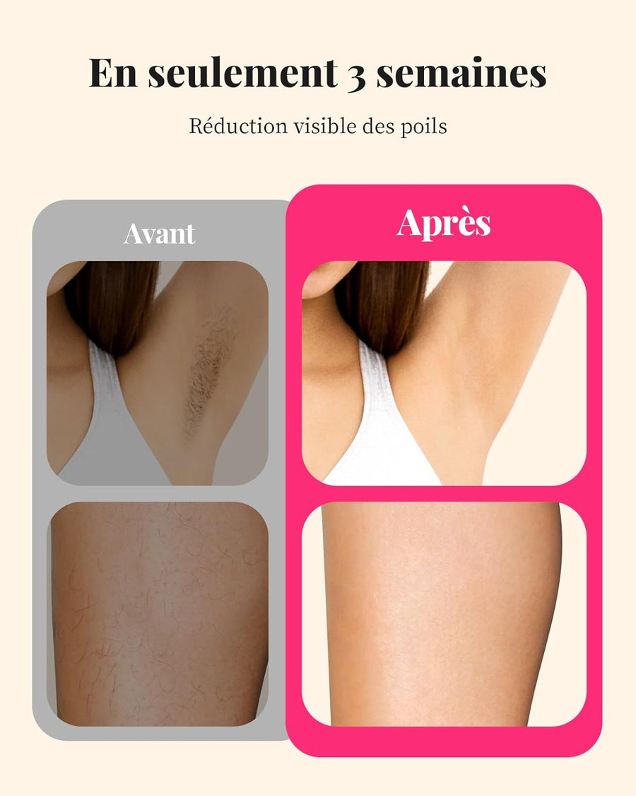 Epilateur Lumière Pulsée Laser 999,900 Flashes IPL Epilation Definitive Indolore corps entier