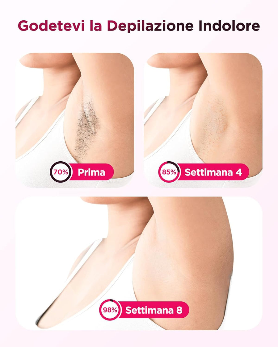 Epilateur Lumiere Pulsée IPL 9 Niveaux 2 Modes Epilation Definitive Corps Visage Aisselle Jambe Maillot