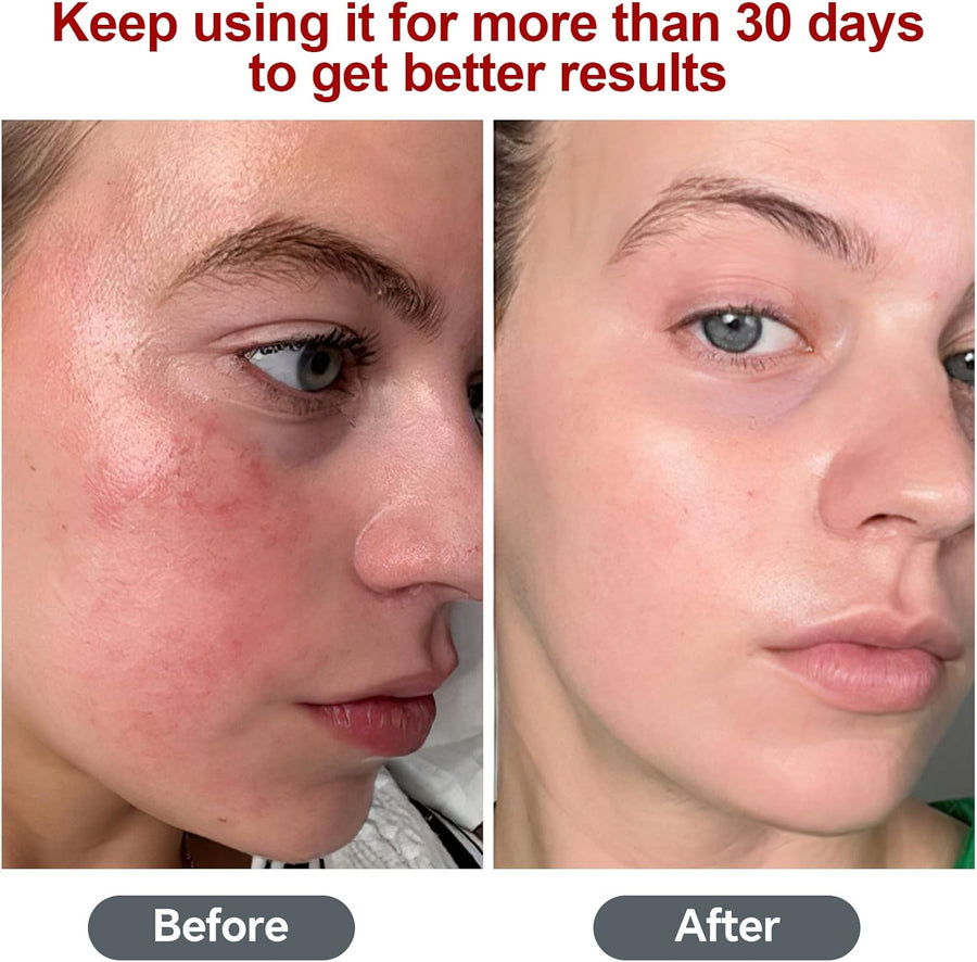 Lampe Infrarouge, Lampe Lumière Rouge Combo 850nm & 660nm, 200 LED Red Light, Pour Visage,Dos, Minuterie 10/20/30 (lumière rouge ne chauffent pas)